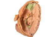 cabeza-y-cuello-mp1660-erler-zimmer2