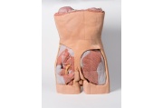 pared-abdominal-posterior-mp1300-de-erler-zimmer1
