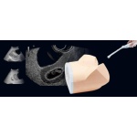 Fantoma de ultrasonido pélvico femenino US-10, US-10A, US-10B, US-10C, US-10D de Kyoto Kagaku