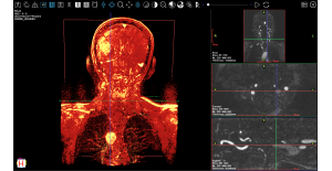 sistema_vascular_y_pulmones