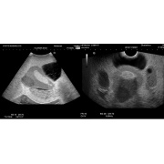 Fantoma de ultrasonido pélvico femenino US-10, US-10A, US-10B de Kyoto Kagaku