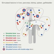 04-fantoma-de-ecografia-abdominal-con-patologias-abdfan-us-1b-de-kyoto-kagaku