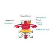 Fantoma de ultrasonido pélvico femenino US-10, US-10A, US-10B de Kyoto Kagaku