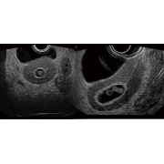 Fantoma de ultrasonido pélvico femenino US-10, US-10A, US-10B de Kyoto Kagaku