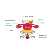 Fantoma de ultrasonido pélvico femenino US-10, US-10A, US-10B de Kyoto Kagaku