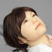 dentaroid-2