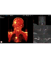 sistema_vascular_y_pulmones