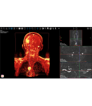 sistema_vascular_y_pulmones